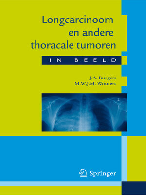 cover image of Longcarcinoom en andere thoracale tumoren in beeld